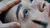 Someone draws on woman's eyelids before cosmetic surgery